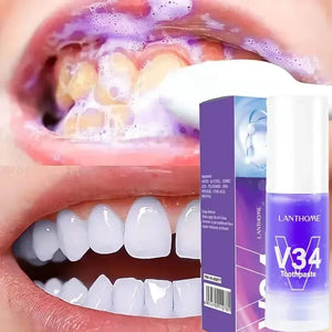 ClariDent - Blanqueador Dental V34